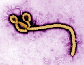 Ebola under a microscope